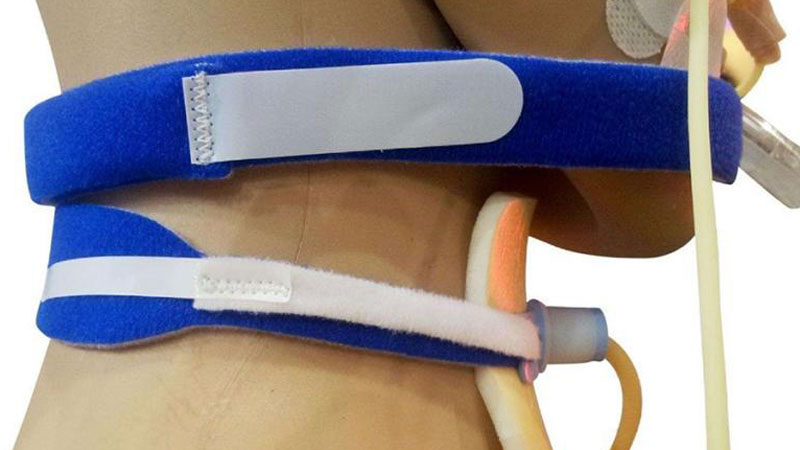 Trachealkanülen Halteband